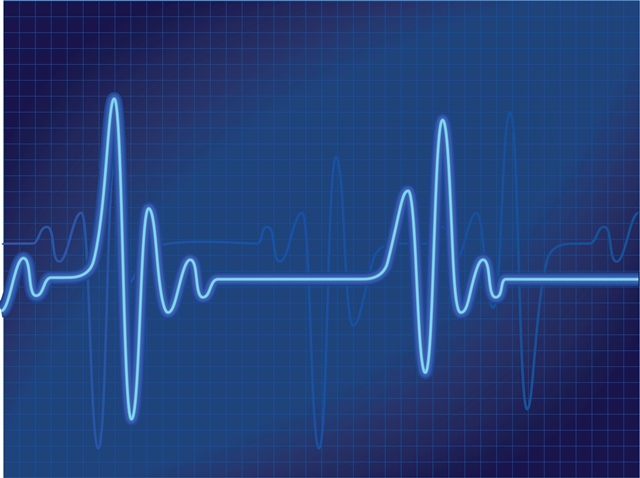 ediscovery_pulse